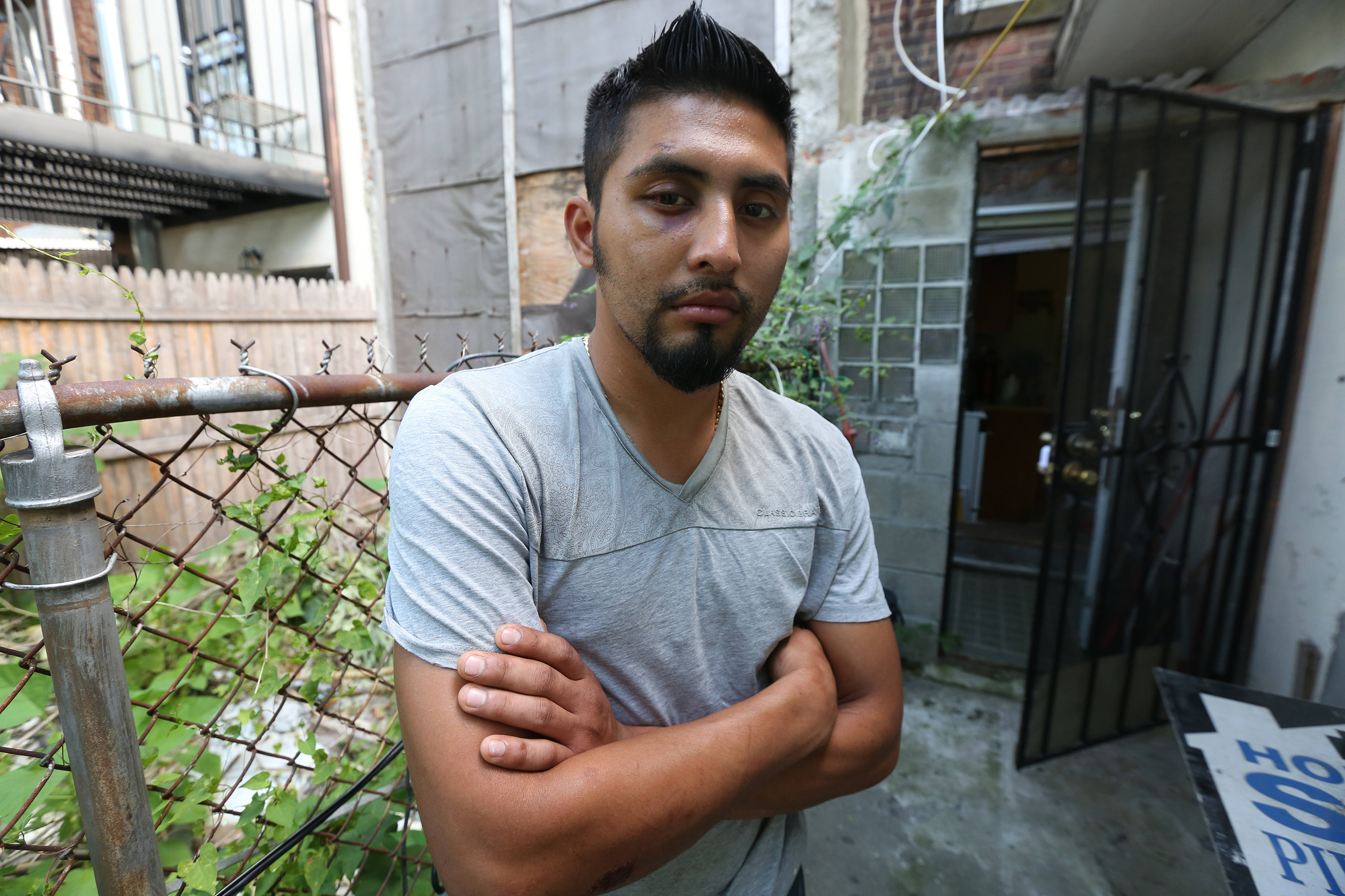 Felix Valenzuela, 25, originario de Guatemala, fue atacado por dos hombres blancos con patinetas en Greenpoint, Brooklyn, en un hecho de crimen de odio. La policia sigue buscando a los agresores. Foto Credito: Mariela Lombard / El Diario.