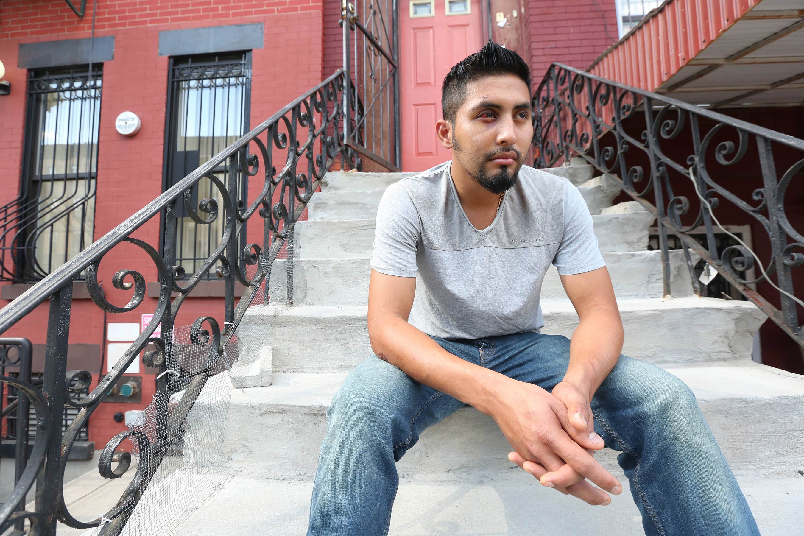 Felix Valenzuela, 25, originario de Guatemala, fue atacado por dos hombres blancos con patinetas en Greenpoint, Brooklyn, en un hecho de crimen de odio. La policia sigue buscando a los agresores. Foto Credito: Mariela Lombard / El Diario.