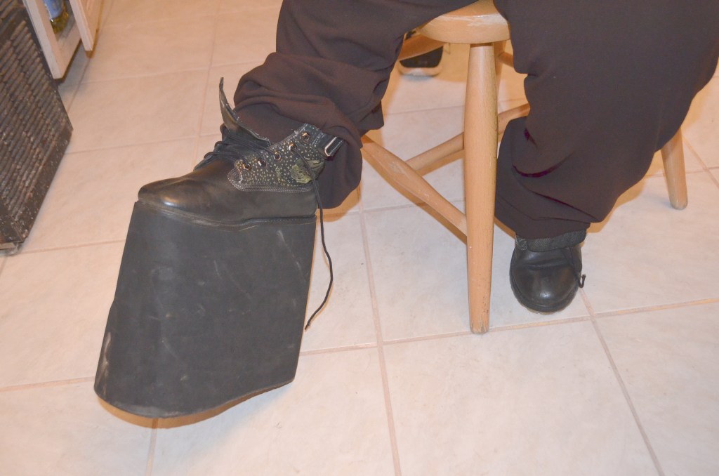 Monserrat Morán dice que el zapato ortopédico que usa es muy pesado y le produce dolor en la cadera y en la cintura. Ella necesita una silla de ruedas eléctrica para movilizarse y no depender de nadie.