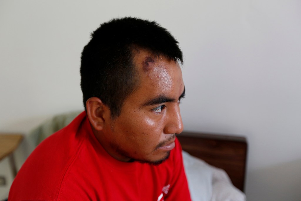 Cuarta Parte: 06/11/16/ TIJUANA/Hugo Nicasio Juarez recibe atencion medica en la Casa del Migrante en Tijuana despues que fue secuestrado, robado y golpeado por su presunto coyote. (Foto Aurelia Ventura/ La Opinion)