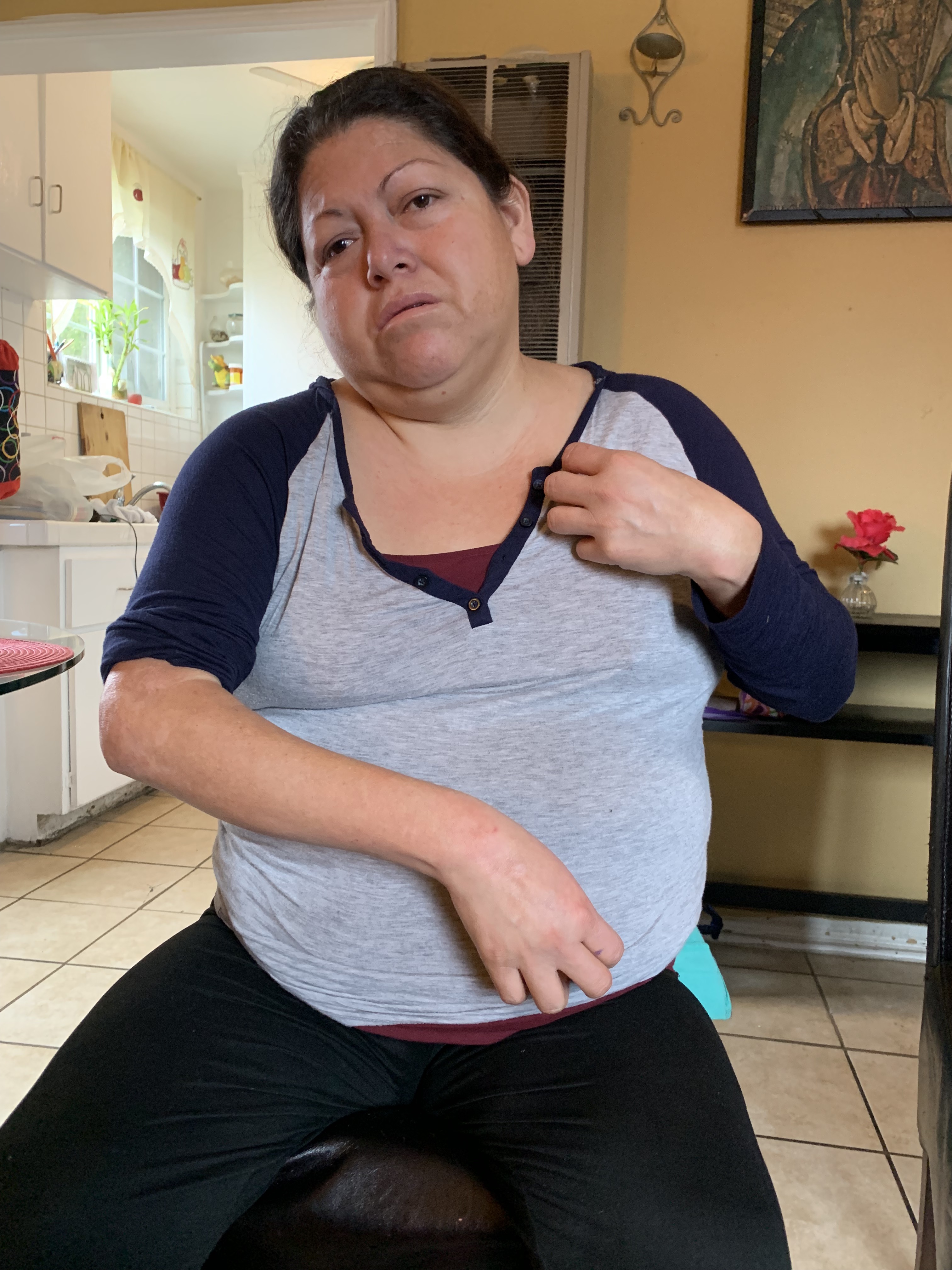 Norma Guzmán no puede trabajar debido a que tiene su brazo y mano paralizadas desde que nació. (Araceli Martínez/La Opinión).