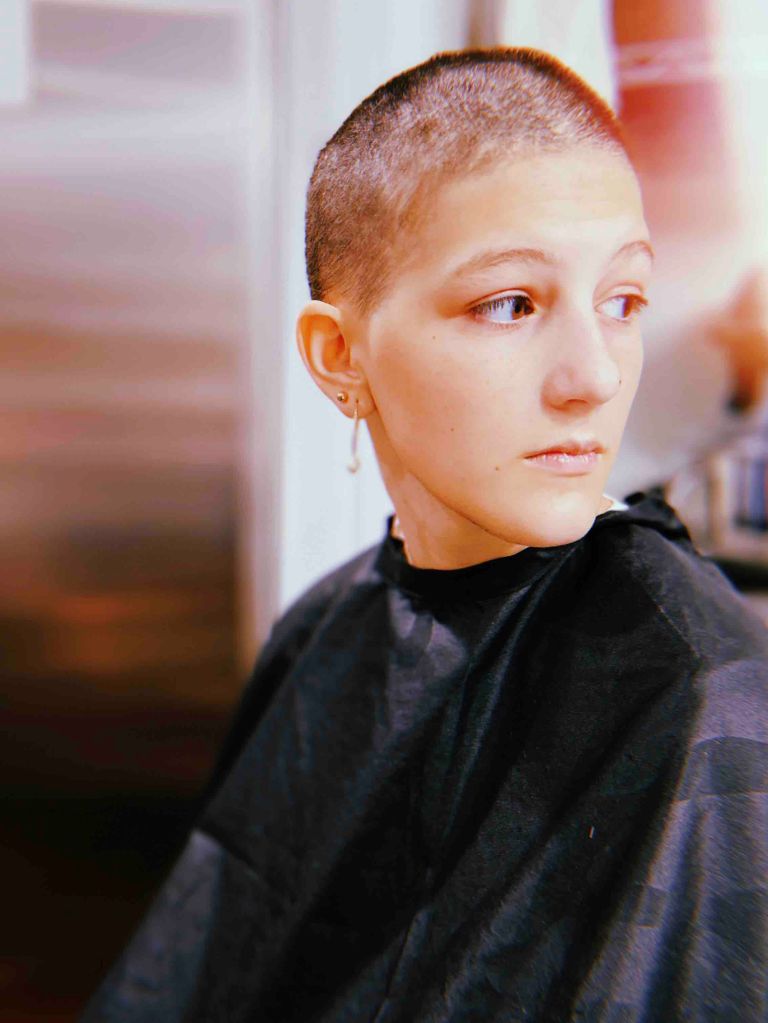 La joven comenzó rápidamente las sesiones de quimioterapia, lo que le acabó costando la pérdida del cabello.